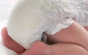 حساسیت به پوشک